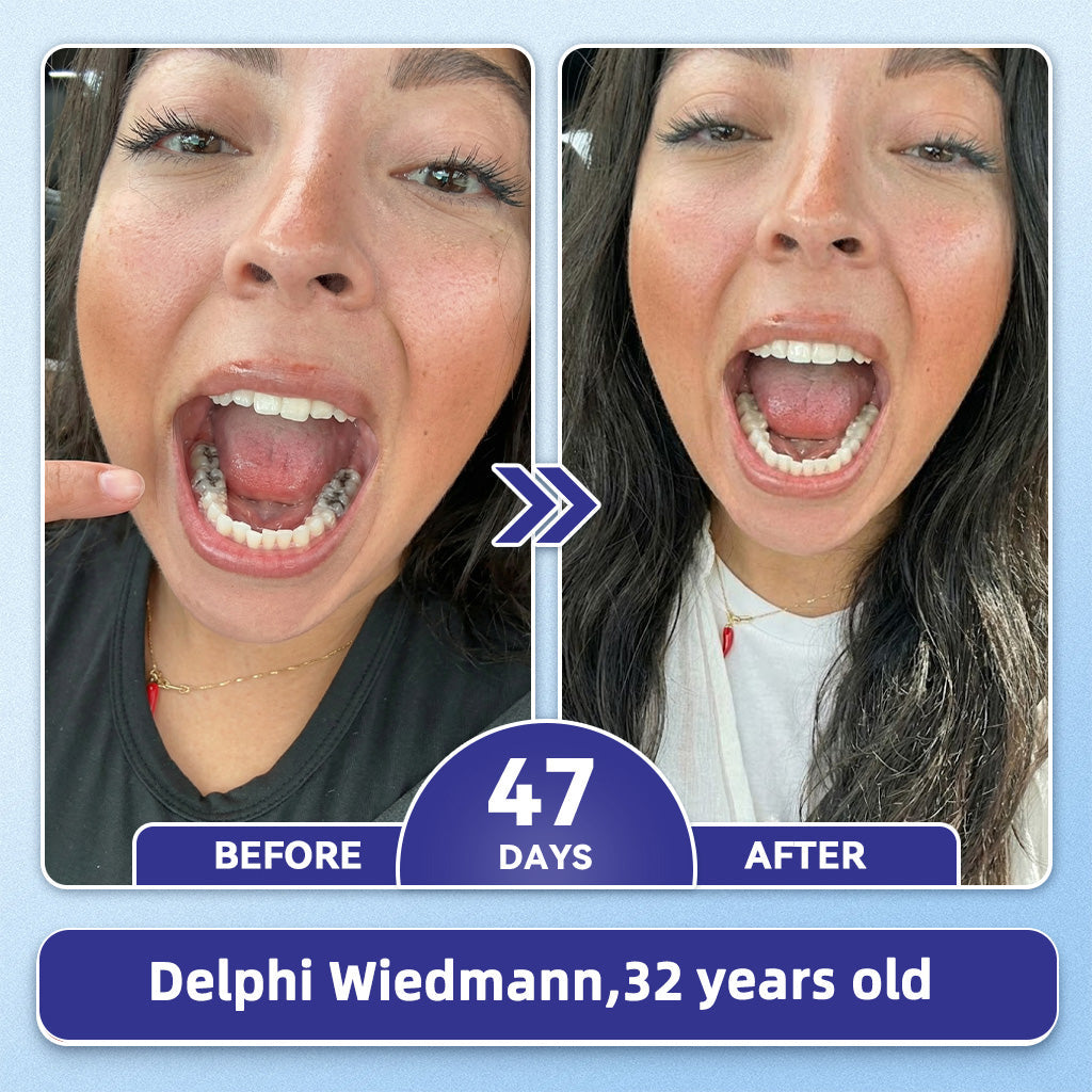 GаrаgеLіnе® 🦷 Tideglusib Fast‑Dissolving Tooth & Gum Repair Oral Strips ✨ (Supports tooth repair and helps relieve gum discomfort and other common oral concerns)