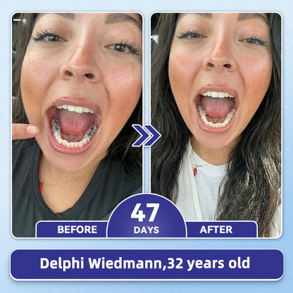 GаrаgеLіnе® 🦷 Tideglusib Fast‑Dissolving Tooth & Gum Repair Oral Strips ✨ (Supports tooth repair and helps relieve gum discomfort and other common oral concerns)