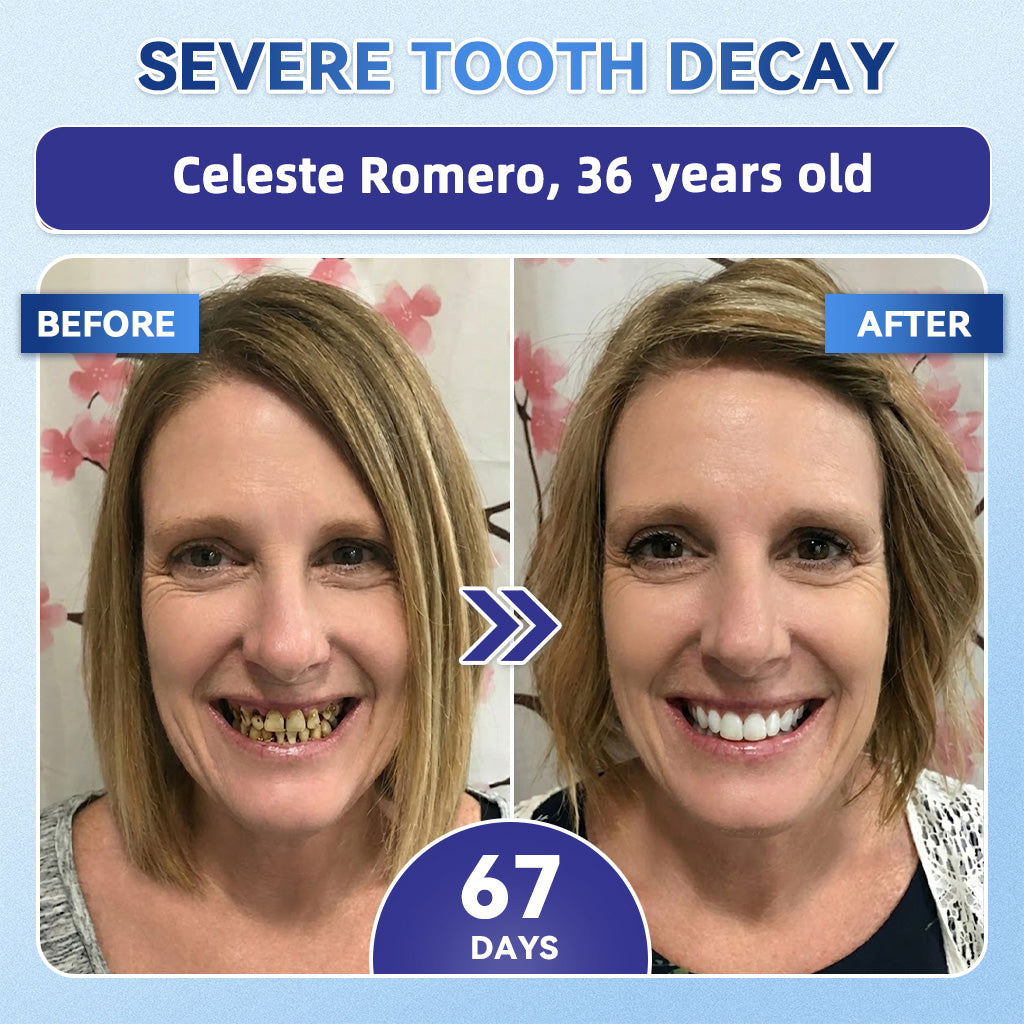GаrаgеLіnе® 🦷 Tideglusib Fast‑Dissolving Tooth & Gum Repair Oral Strips ✨ (Supports tooth repair and helps relieve gum discomfort and other common oral concerns)