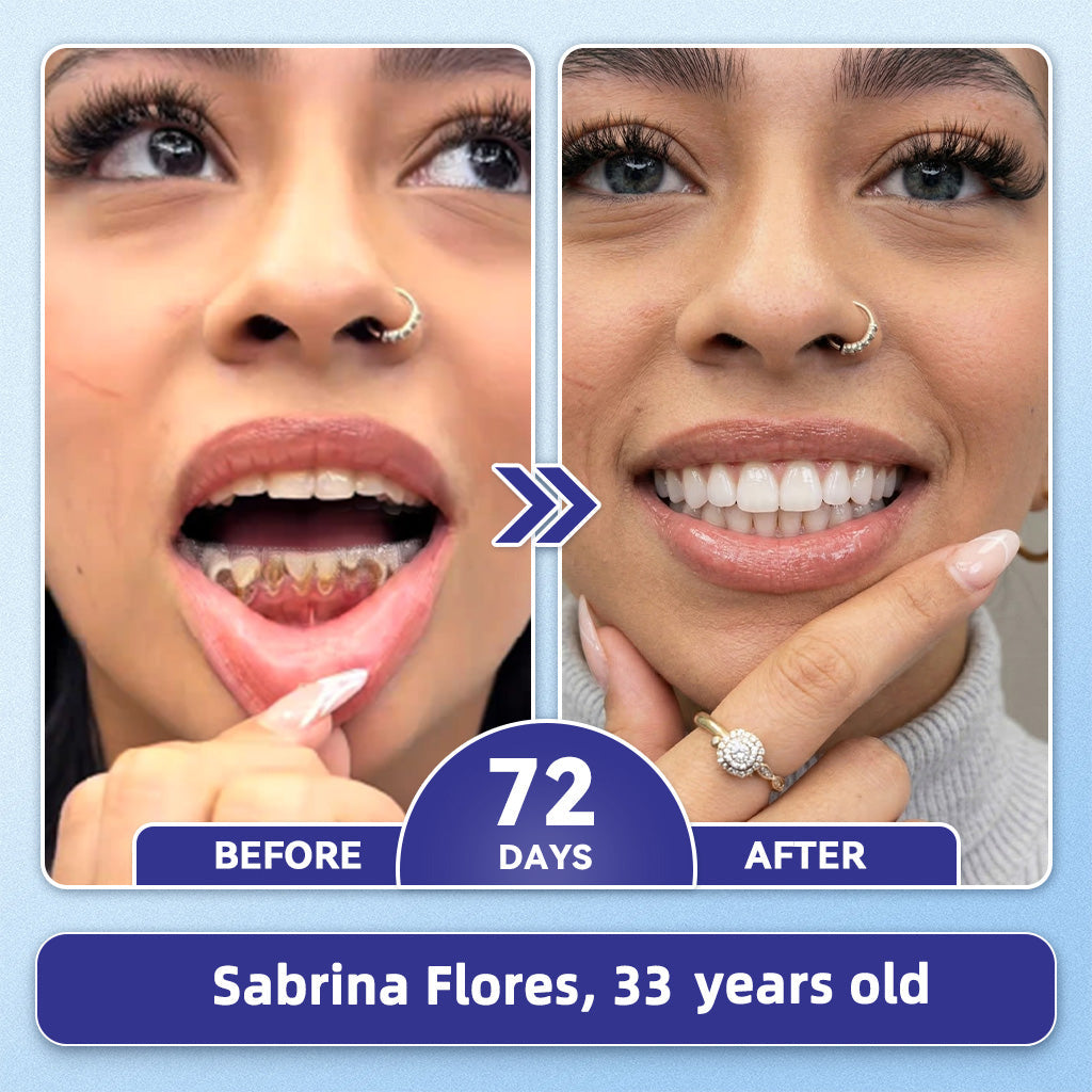 GаrаgеLіnе® 🦷 Tideglusib Fast‑Dissolving Tooth & Gum Repair Oral Strips ✨ (Supports tooth repair and helps relieve gum discomfort and other common oral concerns)