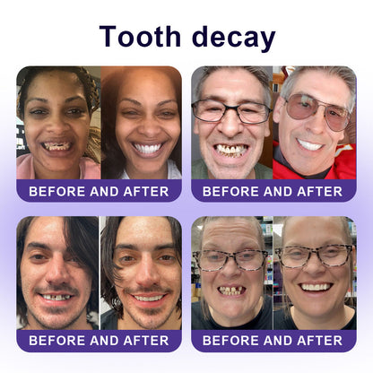 Official Store |🦷GarageLine® Nano-Hydroxyapatite Purple Whitening Strips - Professional Enamel Care & Brightening