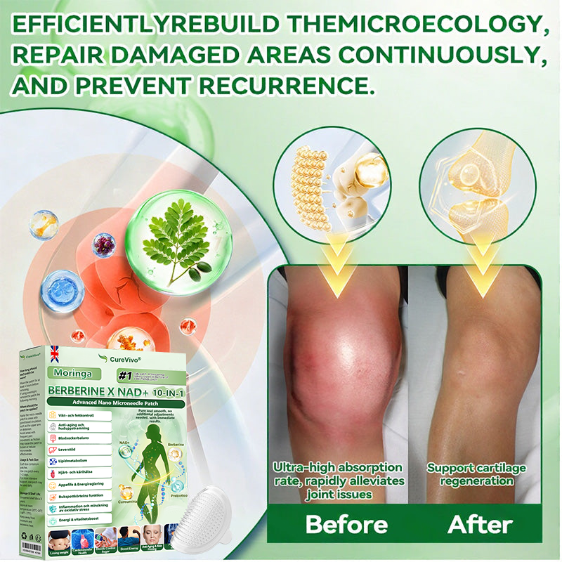 𝐎𝐟𝐟𝐢𝐜𝐢𝐚𝐥 𝐒𝐭𝐨𝐫𝐞 👩🏼‍⚕️ CureVivo® BERBERINE X NAD+ 10-IN-1 Advanced 𝐍ano Microneedle Patch (once daily, visible changes within 7 days) Obesity, diabetes, sleep apnea, and joint problem𝐬