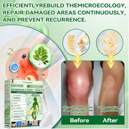 𝐎𝐟𝐟𝐢𝐜𝐢𝐚𝐥 𝐒𝐭𝐨𝐫𝐞 👩🏼‍⚕️ CureVivo® BERBERINE X NAD+ 10-IN-1 Advanced 𝐍ano Microneedle Patch (once daily, visible changes within 7 days) Obesity, diabetes, sleep apnea, and joint problem𝐬