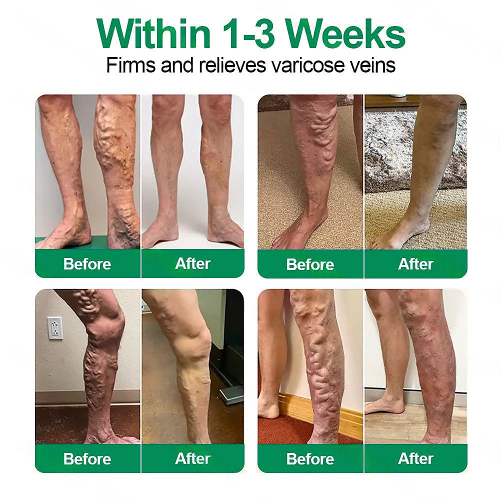 Add a second item and enjoy 78% off!🌿 𝐇𝐞𝐚𝐥𝐫𝐢𝐳𝐞®