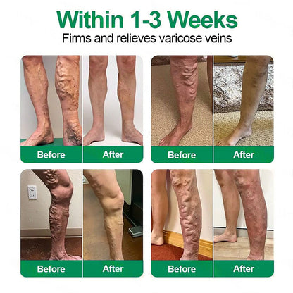 Add a second item and enjoy 78% off!🌿 𝐇𝐞𝐚𝐥𝐫𝐢𝐳𝐞®
