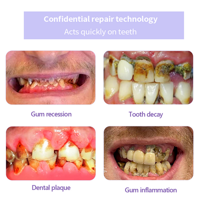 GarageLine® Teeth Restoration Mineral Powder🦷(Suitable for cavities, tooth sensitivity, gum recession, oral inflammation, periodontal problems, and various dental and oral care needs.)