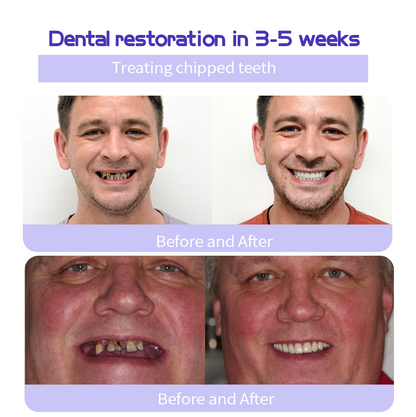 GarageLine® Teeth Restoration Mineral Powder🦷(Suitable for cavities, tooth sensitivity, gum recession, oral inflammation, periodontal problems, and various dental and oral care needs.)